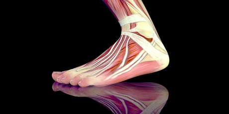 Fasciitis plantaris