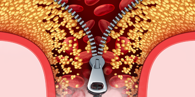 Illustratie cholesterol