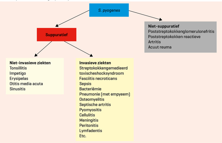 Overzicht presentatievormen groep A-streptokokinfecties