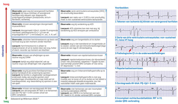 Het Ecg: Waar Ligt De Grens Voor De Huisarts? | Huisarts & Wetenschap