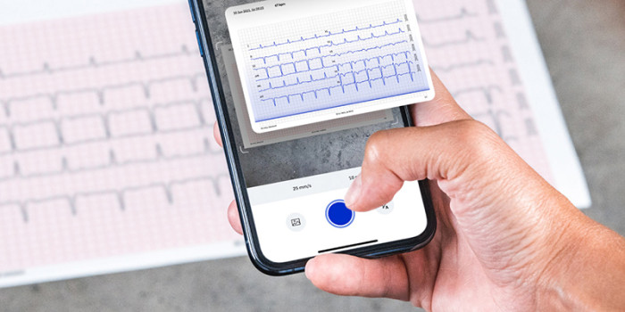 AI ecg-app